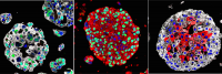 organoidsc-created-from-bladder-cancers-of-individual-patients